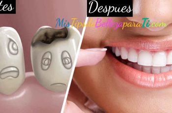 Mira lo que pasa si no acudes al odontólogo por lo menos dos veces al año Mira lo que pasa si no acudes al odontólogo por lo menos dos veces al año